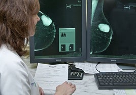 La lista de espera del cribado de cáncer de mama se extiende a Toledo y afecta al menos a  otro millar de mujeres