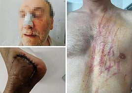 Las lesiones que han sufrido funcionarios de prisiones en actos de servicio