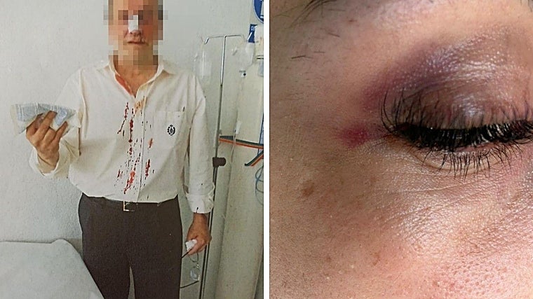 Más funcionarios de prisiones lesionados por los internos