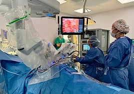 El Hospital Doctor Peset, primer centro de la Comunidad Valenciana en incorporar la cirugía robótica para tratar el cáncer de esófago