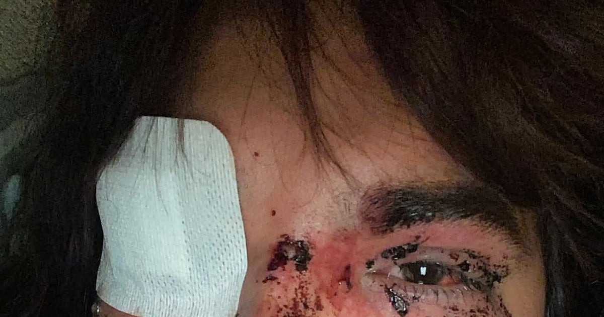 La víctima, sobre sus agresoras: «Me duele más porque son del colectivo y saben lo que se sufre»