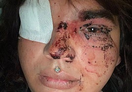 Cinco detenidas de entre 18 y 24 años por la «brutal agresión» a una mujer trans en un pub de La Bañeza (León)