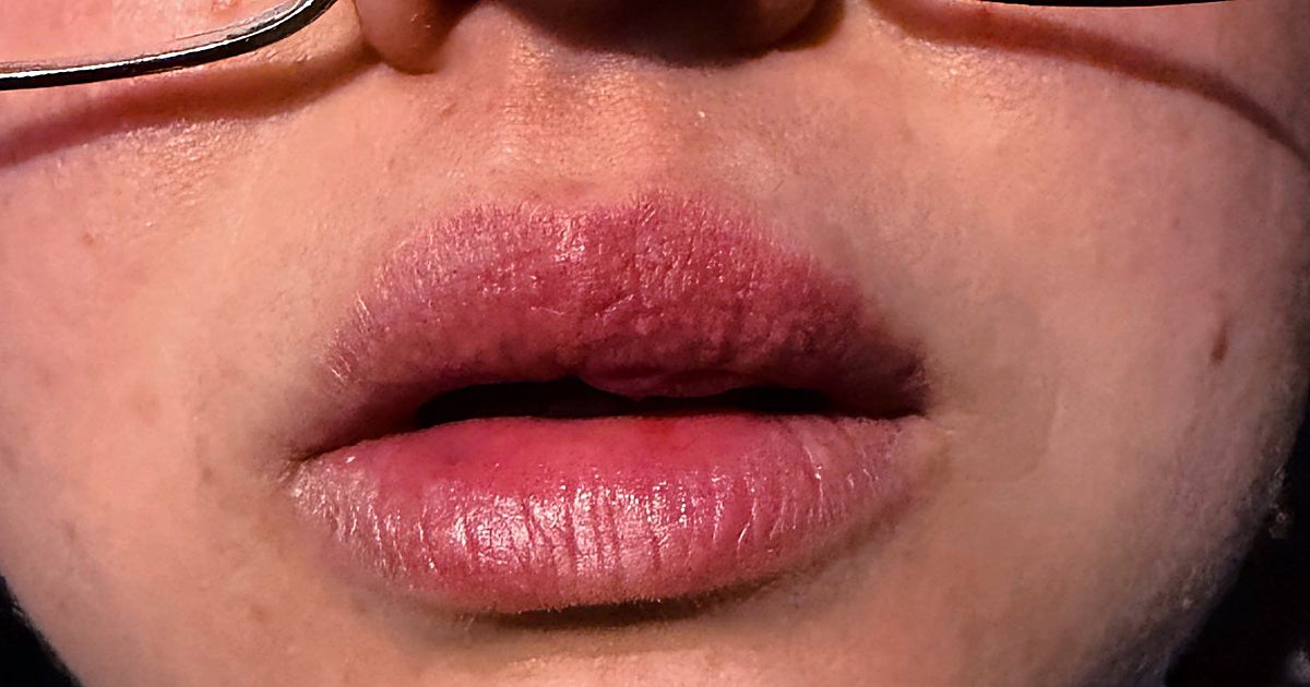 La banda Cristo de Gracia denuncia que una de sus miembros sufrió un golpe en el labio el Jueves Santo de Córdoba