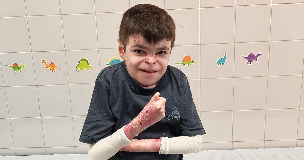 Juanma Moreno celebra la primera vacuna de Leo, el niño sevillano con piel de mariposa: «¡El gran día ha llegado!»