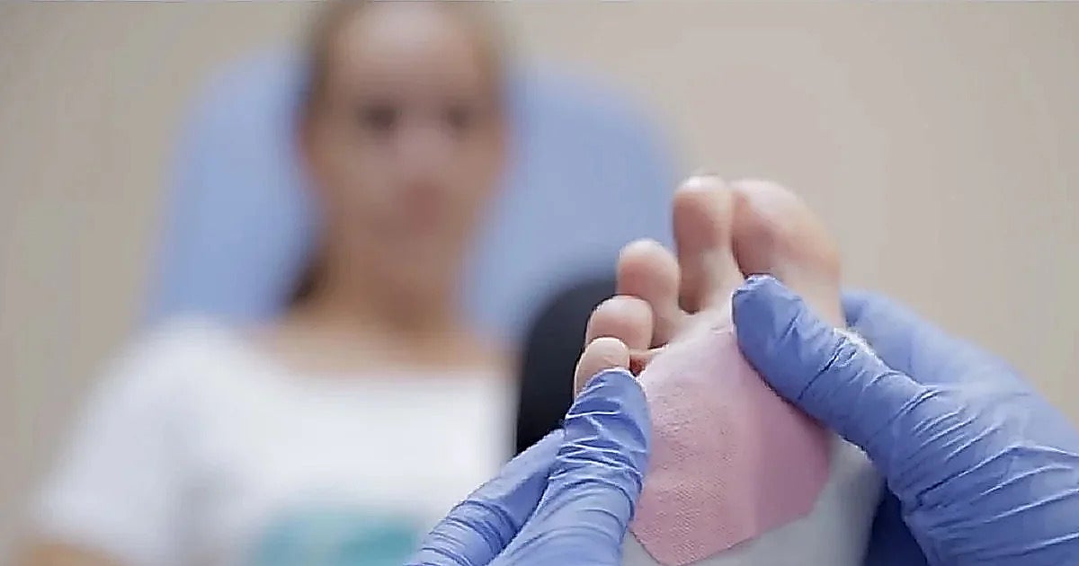 Jorge Escoto, podólogo, advierte del peligro de cambiar de zapatos en primavera: «Dispara las lesiones»