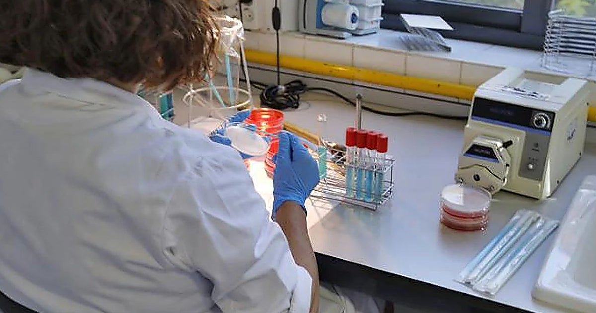 Castilla y León refuerza los controles tras una alerta por listeriosis vinculada a un queso elaborado en Palencia