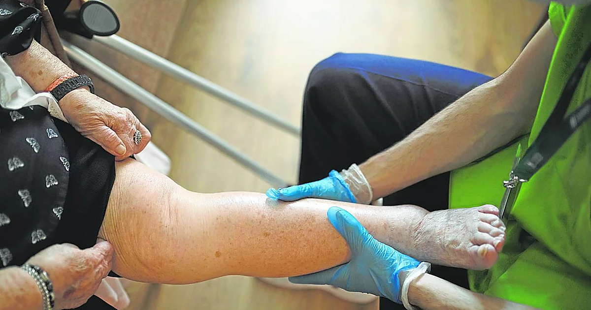 El médico de Atención Primaria ya puede derivar a Fisioterapia a sus pacientes para recortar los plazos