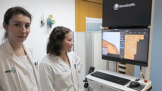 Ciudad Real refuerza la detección precoz del melanoma con un dermatoscopio de última generación