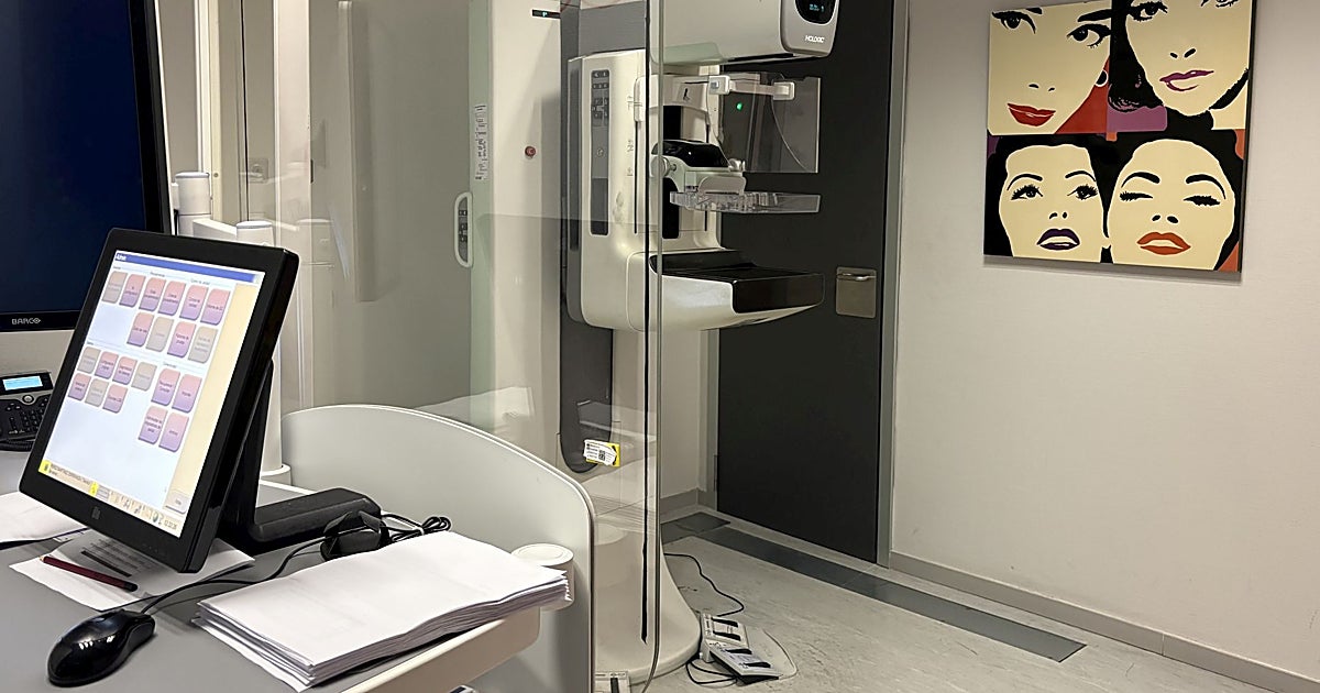Castilla-La Mancha participa en el primer estudio español para predecir el riesgo personalizado de cáncer de mama