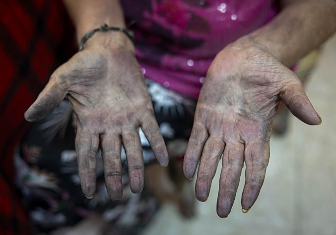 Las manos de Rita tras la limpieza, llenas de ceniza.