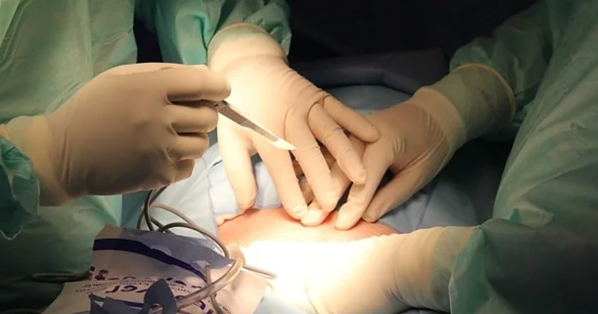 El TSJC reconoce a la incapacidad temporal de una trabajadora por complicaciones de una operación de estética