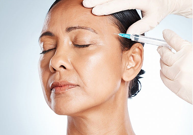 Ácido poliláctico: qué es y cómo actúa el inyectable que combate la flacidez facial y la celulitis