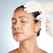 Ácido poliláctico: qué es y cómo actúa el inyectable que combate la flacidez facial y la celulitis
