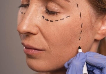 Locos por la estética: ¿quién no se ha hecho un retoque todavía?