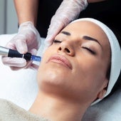 Dermapen: qué es y qué beneficios tiene para la piel