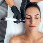 Cómo cuidar la piel del rostro en casa después de un tratamiento estético