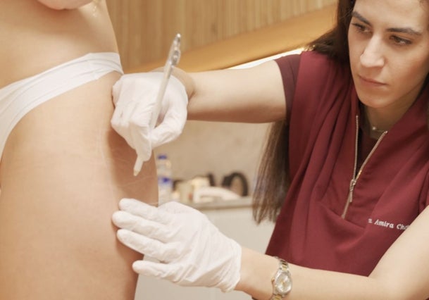 La armonización de glúteos con la doctora Clínica Chehade de Novo.