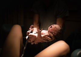 La cesárea humanizada recupera el vínculo entre madre e hijo en el momento del nacimiento