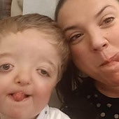 «'¿Cuándo tiene tu hijo pensado ponerse bien?', me preguntó la mutua»