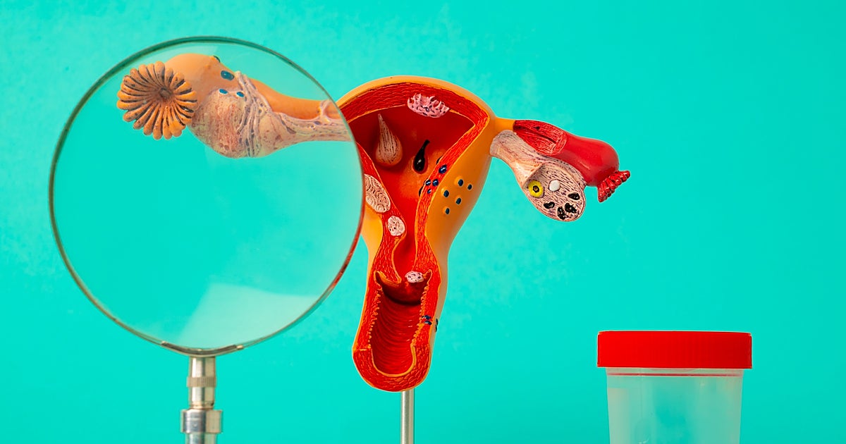 Una pediatra especialista en infecciosas: «Todas las semanas vemos casos de adolescentes con gonorrea y clamidia»