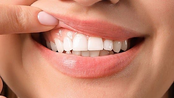 Cepillo dental eléctrico con sensor de presión: la función que evita que te destroces las encías