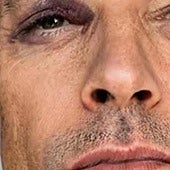 El accidente sufrido por Jesús Vázquez en sus vacaciones que ha despertado la preocupación entre sus seguidores