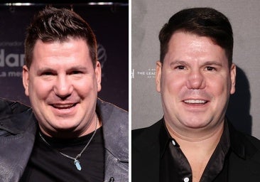 Lucas, del dúo Andy y Lucas, zanja la polémica de su posible nariz operada: «Me