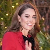 Desvelan la historia que hay detrás de la cicatriz que Kate Middleton tiene en la cabeza: «Un bulto potencialmente grave»