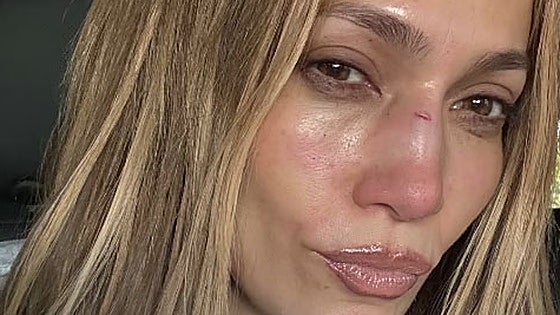 El accidente de Jennifer Lopez durante los ensayos de los Premios AMA: «Esto es lo que pasó»