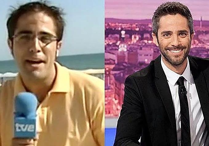 Antes y después de Roberto Leal.