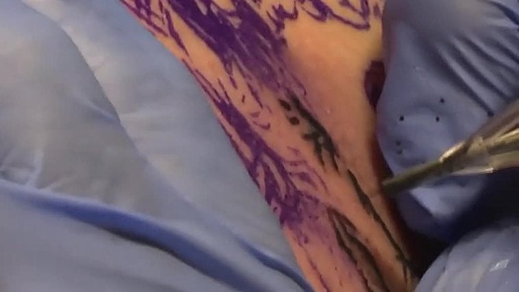 El "Rembrandt de los pobres", el nuevo arte corporal