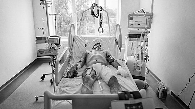 Un soldado se recupera de las quemaduras sufridas, en el Hospital de San Lucas, Leópolis