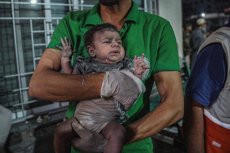 Un niño herido es trasladado al hospital Al-Shifa después de haber sido herido en un ataque aéreo israelí