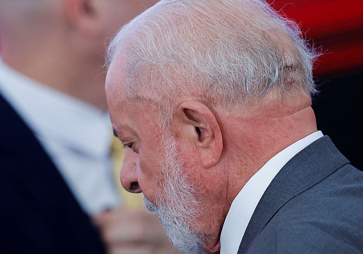 Una vista muestra una herida en la cabeza del presidente brasileño Luiz Inácio Lula da Silva, en una imagen de octubre de 2024
