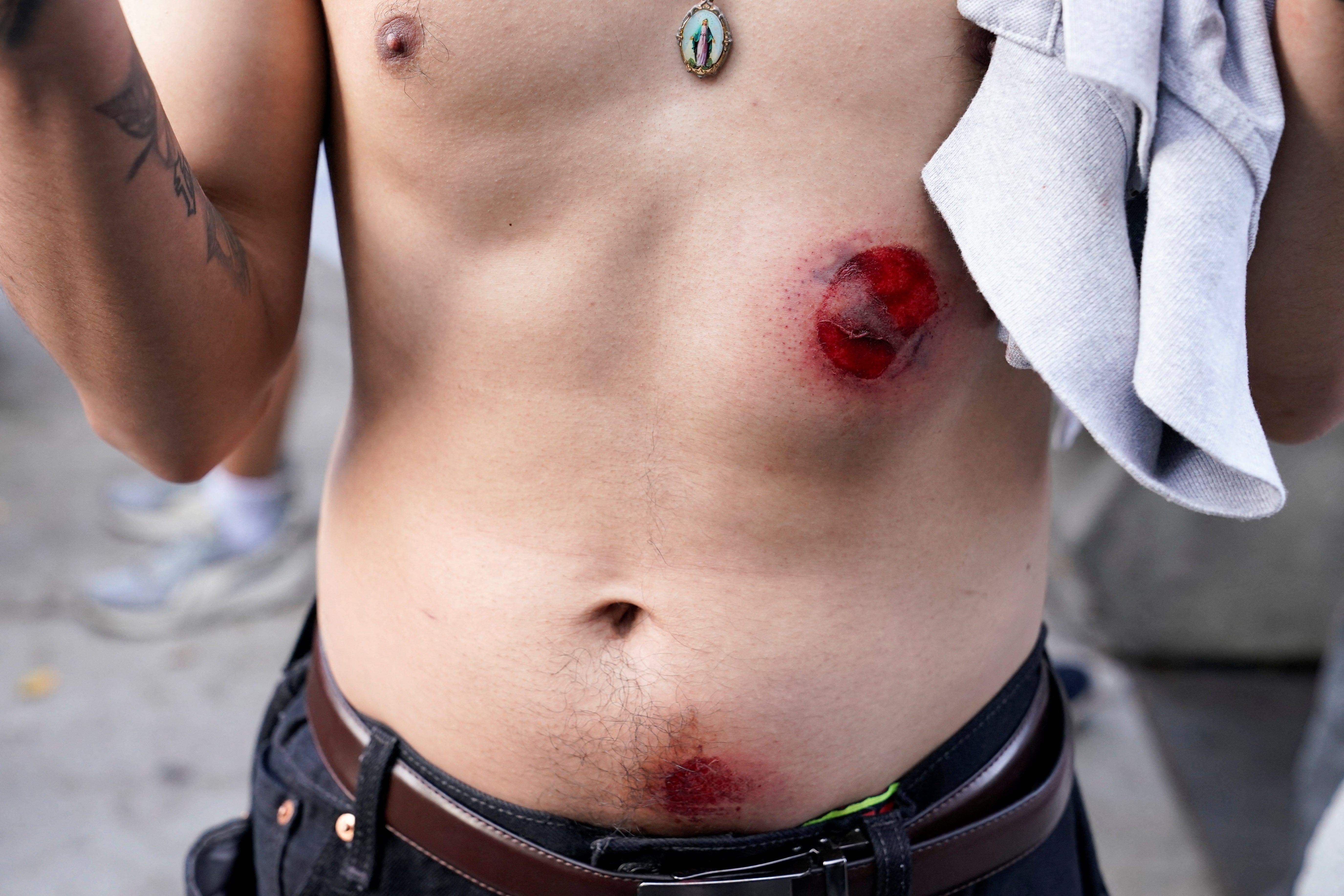 Un hombre muestra las heridas provocadas por la Policía