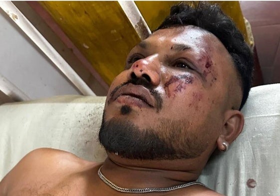 Vishwash Kumar Ramesh, el superviviente del asiento 11A: «Treinta segundos después del despegue, hubo un ruido fuerte y luego el avión se estrelló»