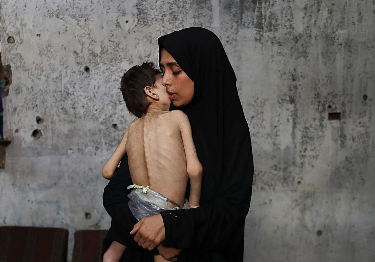 Samah Matar, una madre palestina desplazada, sostiene a su hijo desnutrido Youseff en una escuela donde se refugian en medio de la crisis de hambre en Gaza