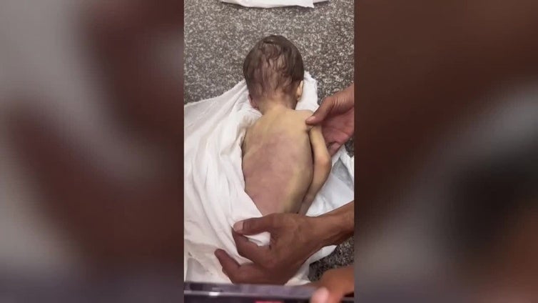 Sanidad de Gaza registra 4 muertos más por desnutrición