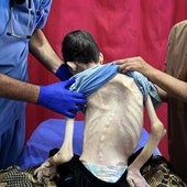 Israel, cada vez más enemistado con Occidente por la hambruna en Gaza