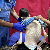 Contando calorías en el infierno: lo que contienen las polémicas cajas de ayuda en Gaza y por qué no resuelven la crisis