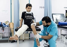 El milagro de reconstruir el cuerpo y el alma de los heridos en las guerras de Oriente Próximo