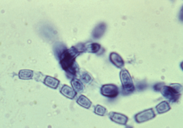 Los supermicrobios en forma de esporas microscópicas de hongos son una amenaza creciente: «Algo está pasando que se están adaptando y son capaces de provocar lesiones graves»