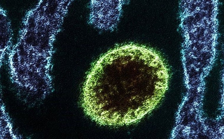 Detectado un nuevo virus zoonótico en China con 35 infectados confirmados