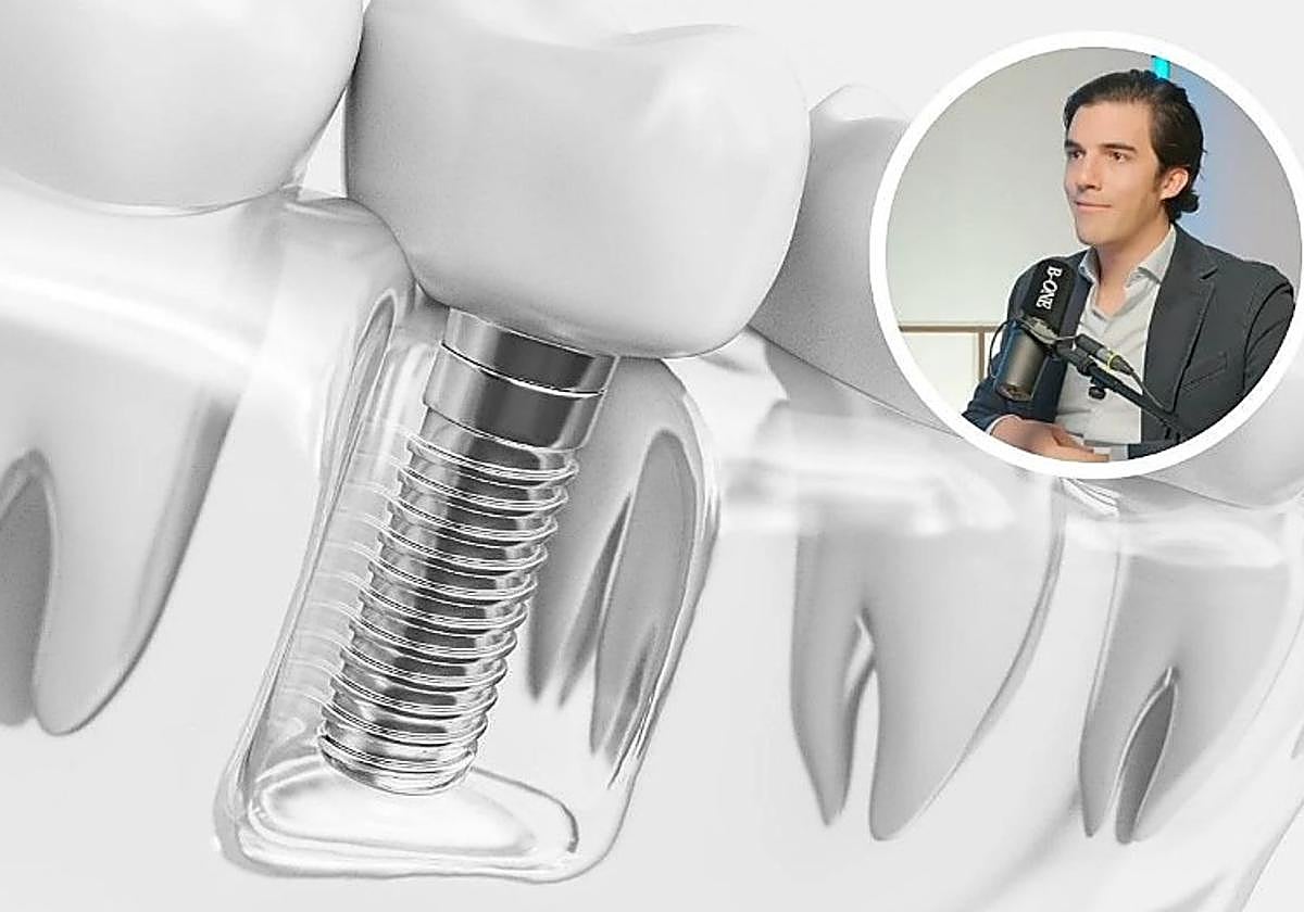 Javier Calatrava, odontólogo: «El implante dental es un arma de doble filo. Cuando te lo colocas, te casas con él y, si falla, las soluciones pueden ser mucho más complejas»