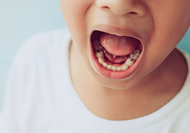 Francisco Estefo, cirujano dentista: «Jamás te van a decir este secreto para tus caries»