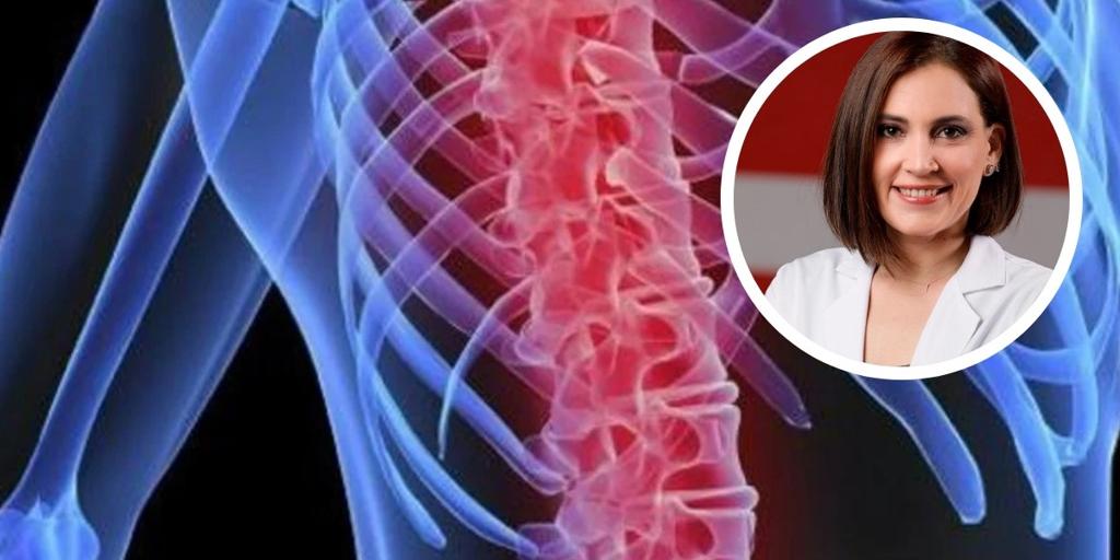 Boticaria García, nutricionista, indica los nutrientes que se deben tomar para fortalecer los huesos: «Valora que sean eficaces»