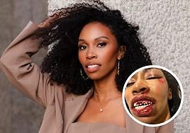 Carrie Bernans, actriz de 'Black Panther' y 'Vengadores', muy grave tras ser atropellada por un coche