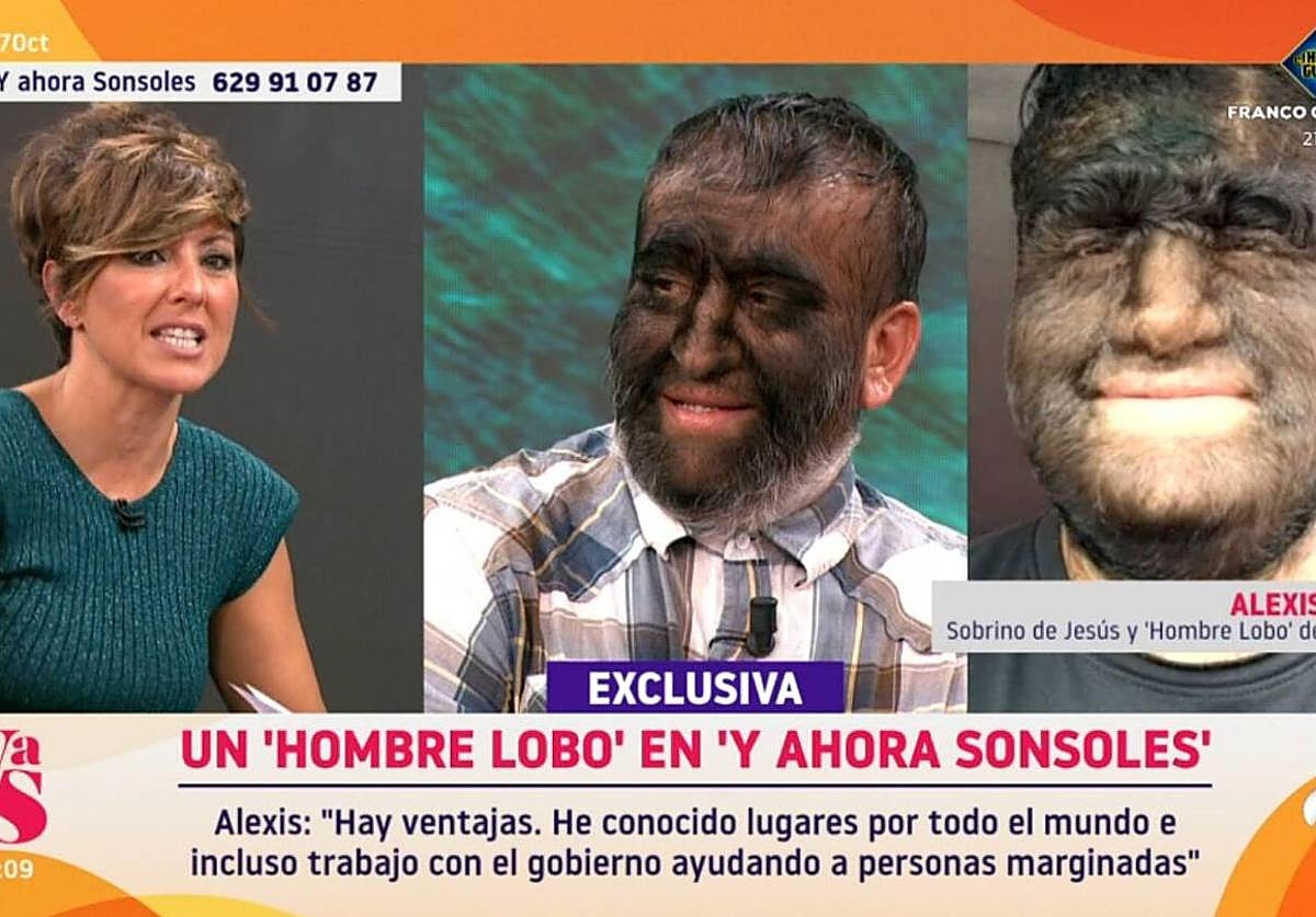 Un hombre lobo en 'Y ahora Sonsoles'