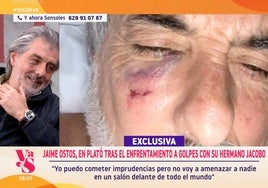 Jaime Ostos Jr. relata cómo vivió la brutal agresión de su hermano: «Tiene antecedentes de violencia»