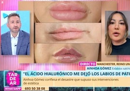 La tendencia «fuera labios salchicha» que está extendiéndose entre las famosas